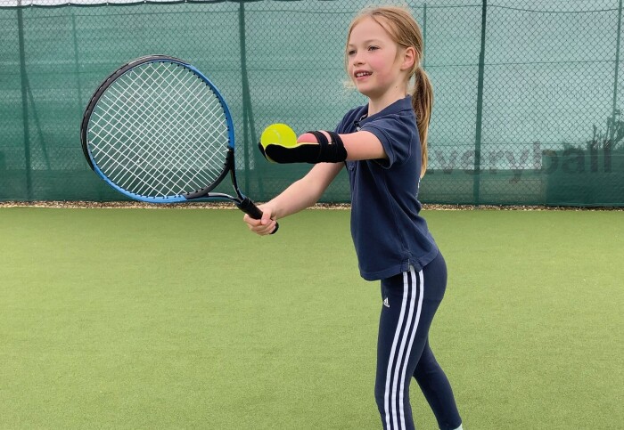 A girl plays tennis with a prosthetic hand
