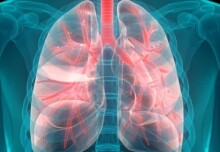 ‘Virtual biopsy’ uses AI to help doctors assess lung cancer  