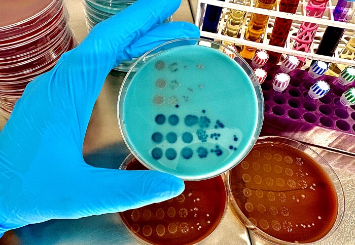 Gut bacteria could help block the rise of antibiotic-resistant ...