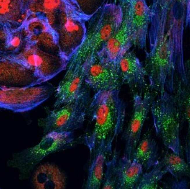 The AXL molecules (green) drive cancer cell growth (red)