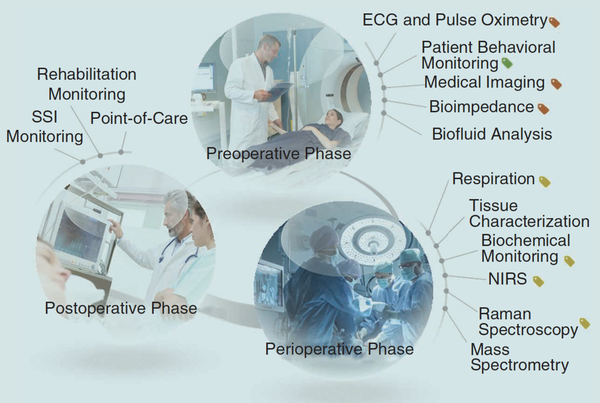 The perioperative-care pathway and examples of sensors that can address different requirements.