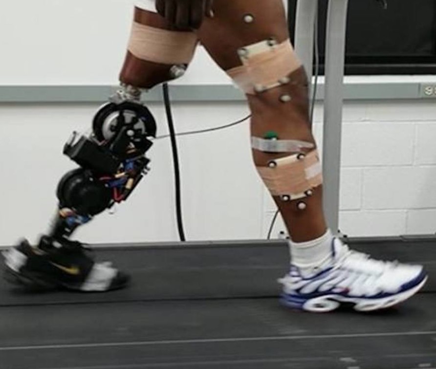 robotic leg for amputees