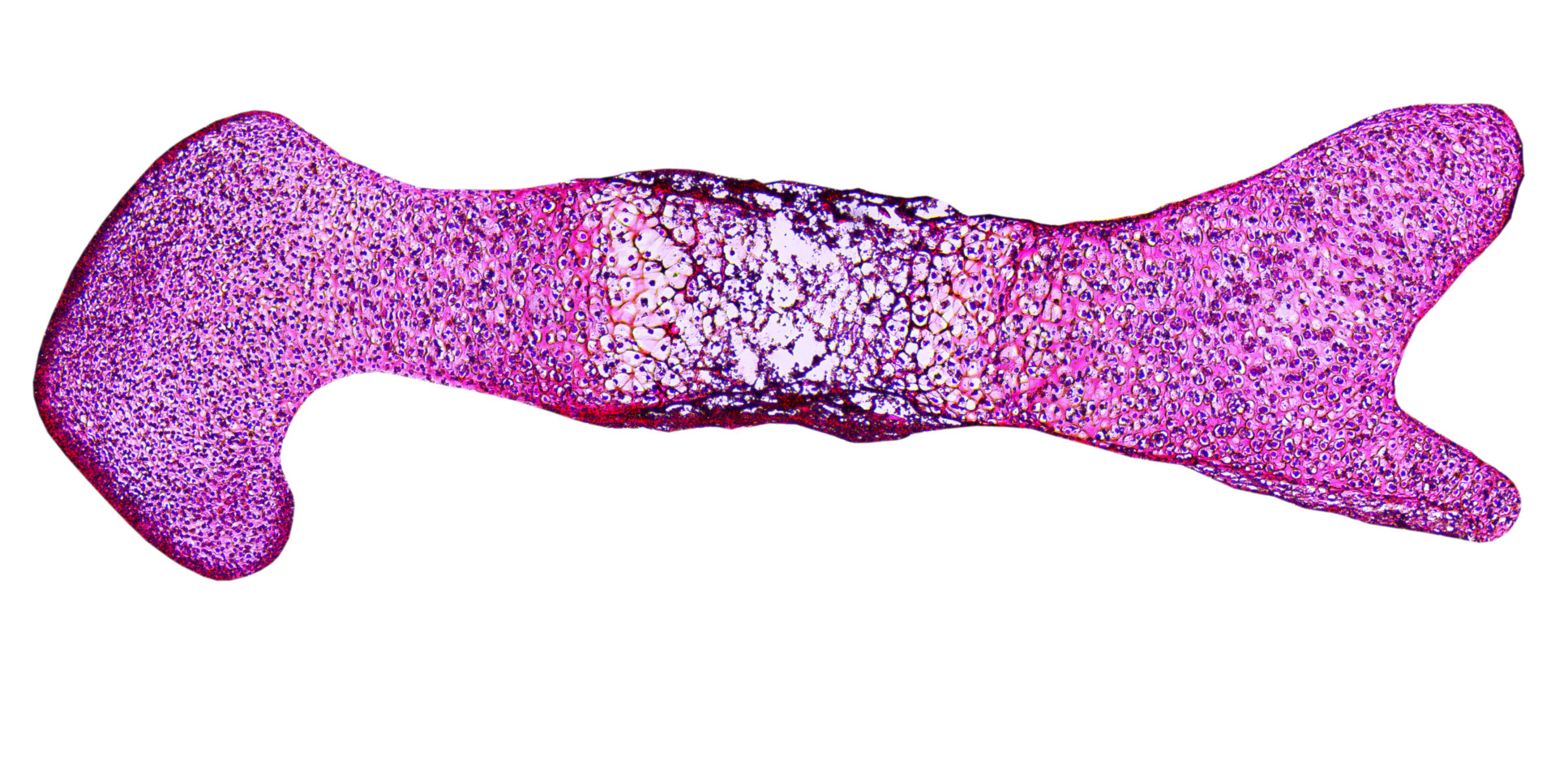 a developing mouse embryo femur stained for collagen. 