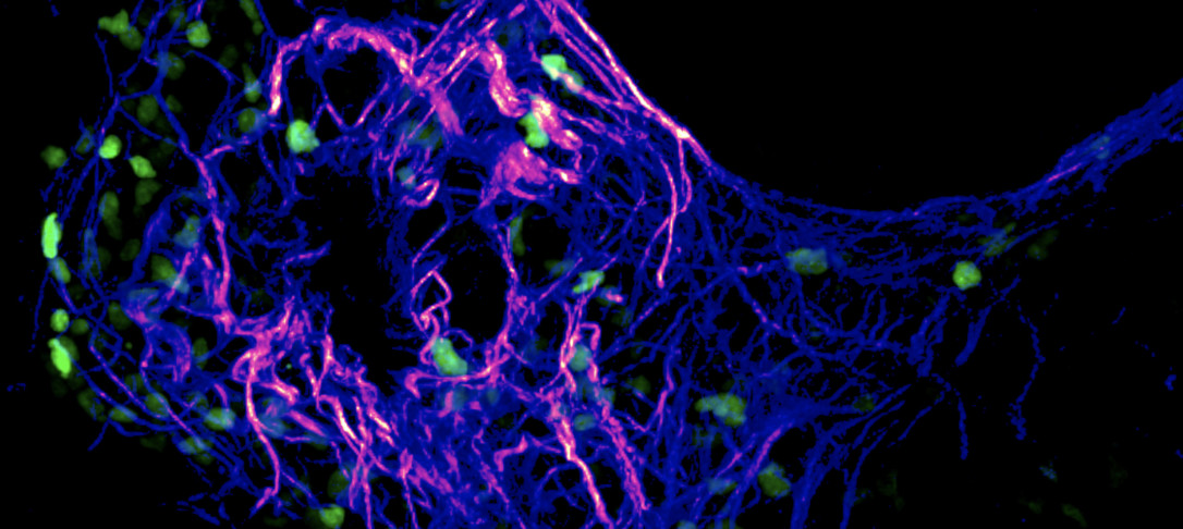 Visualising cell-matrix interactions in lung inflammation