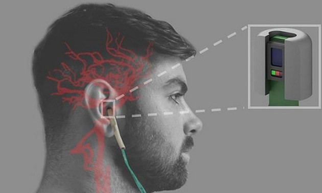 Illusrtration of in ear device