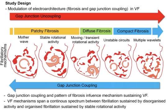 The fibrillation electrophenotype spectrum.