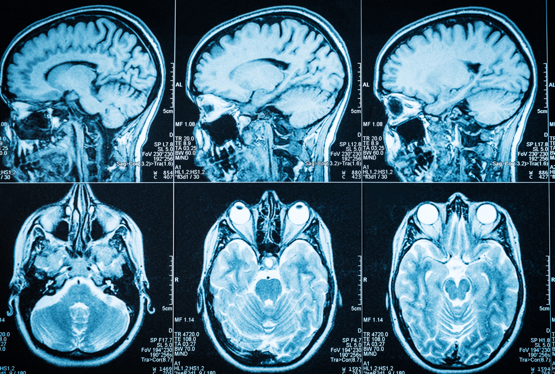 CT scan images of human brain