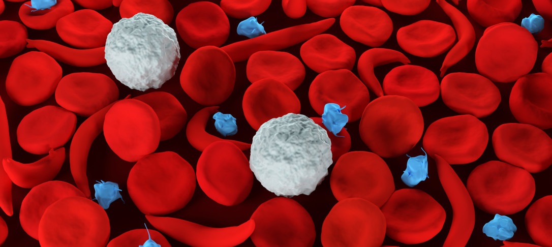 Sickle cells