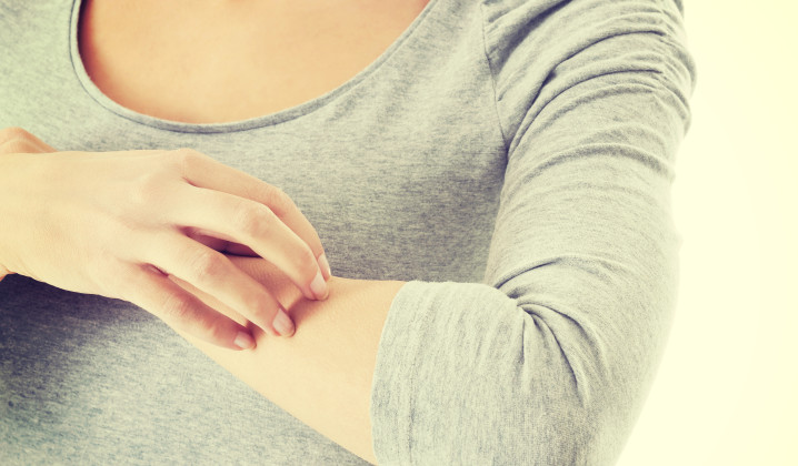 Allergic skin disease and drug allergy