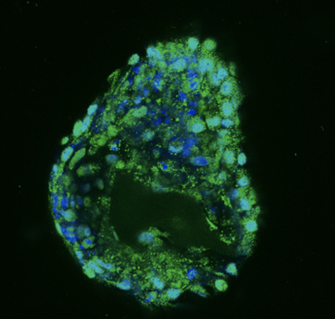 Confocal microscope image of cartilage cells growing within 3D printed scaffolds - stained for Aggrecan (green) and nuclei (blue). Scale bar 200 μm