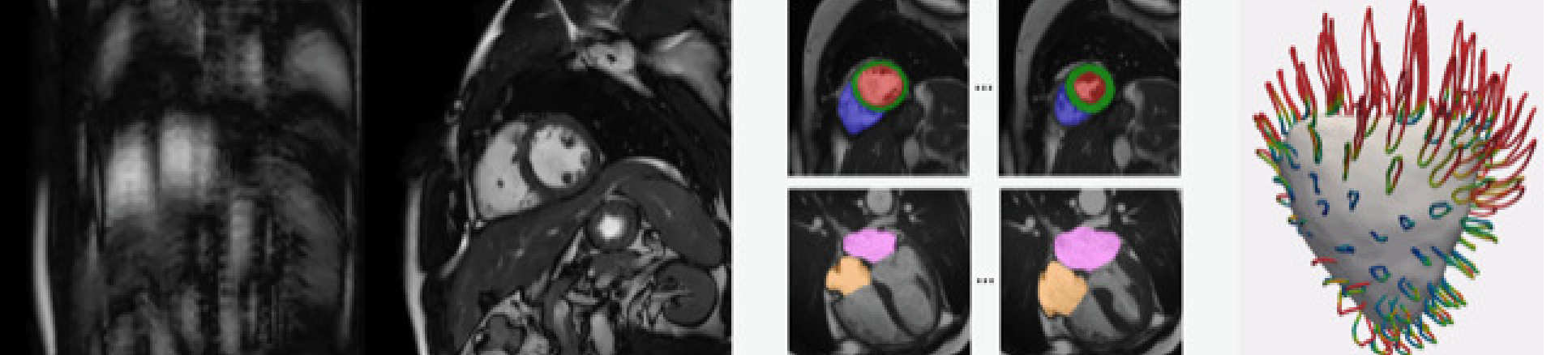 medical image