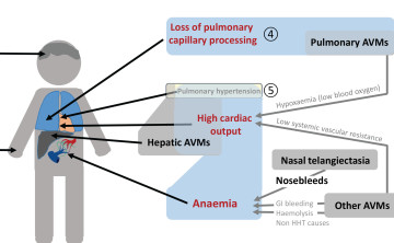 VASCERN HHT Fig 2