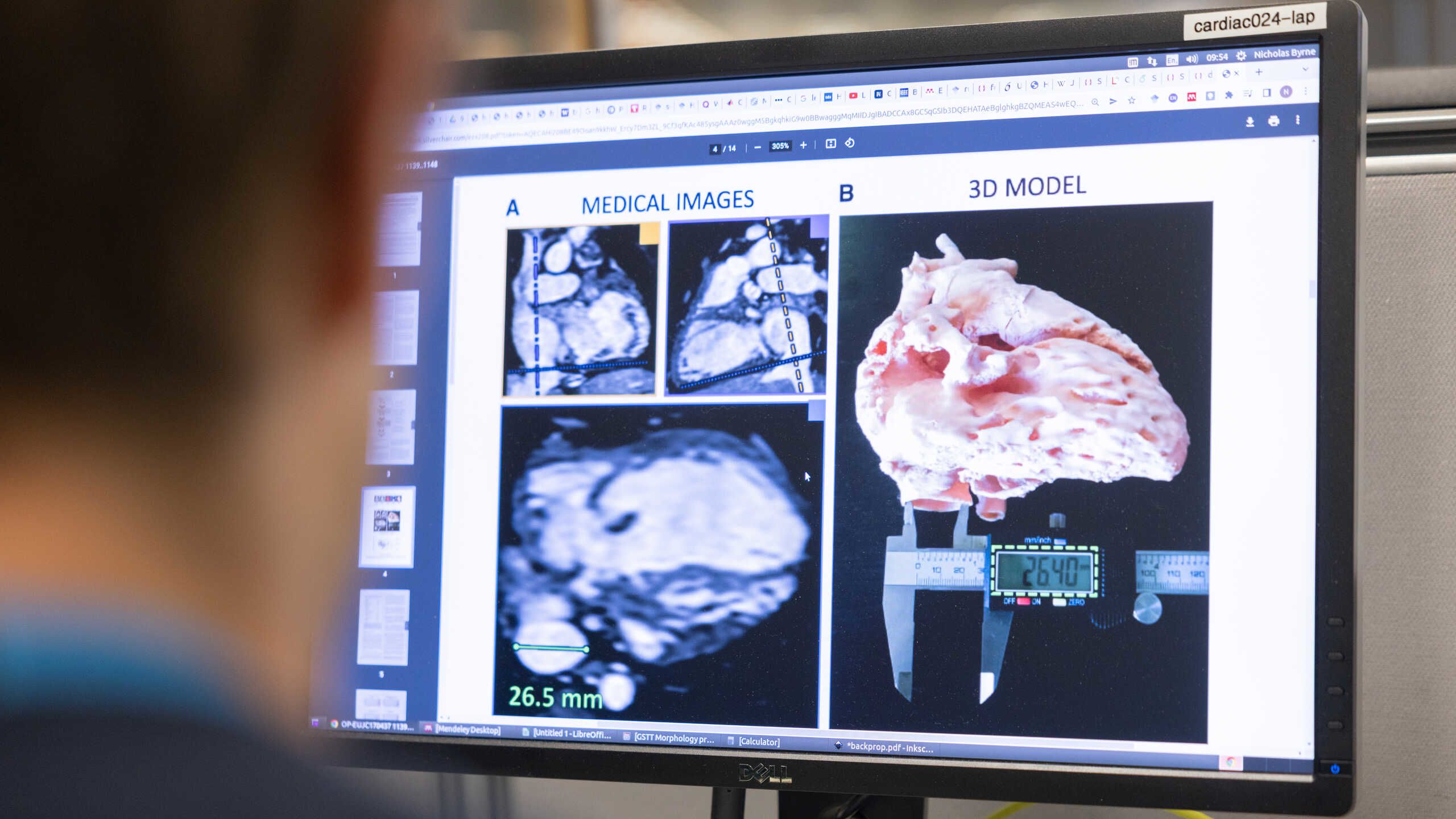 Screen with images of the heart