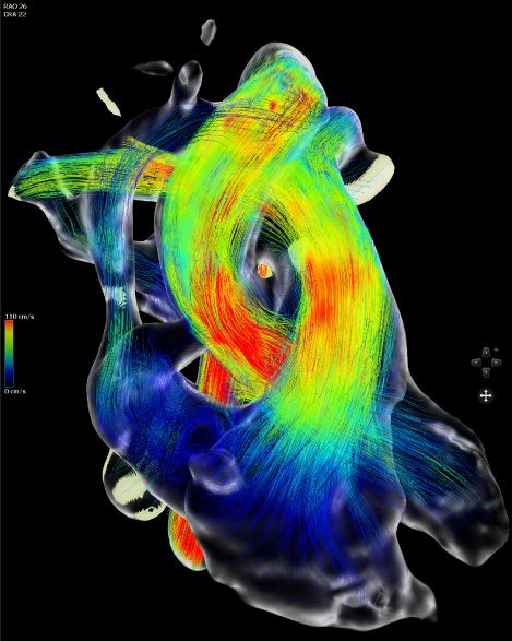 Computational image of a heart