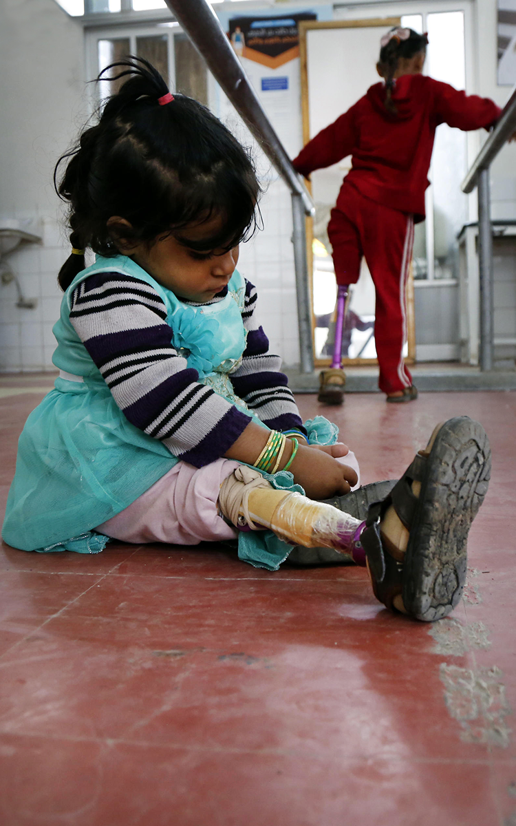 two children with prosthetics walk in a clinic