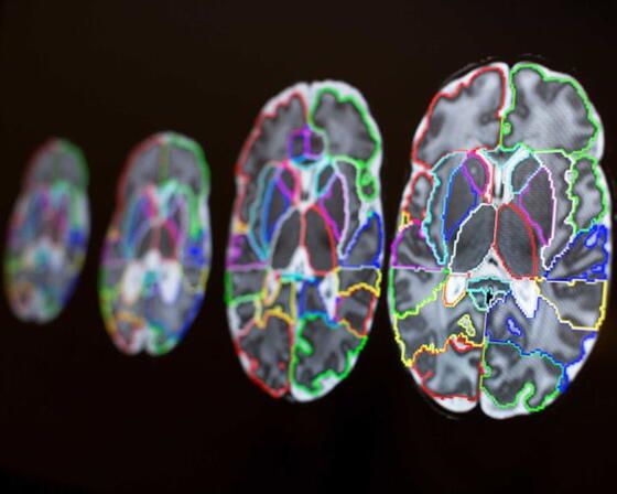 Brain scans