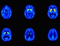 serotonin receptors