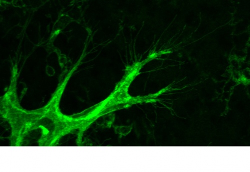 Sprouting angiogenesis in the developing mouse retina at postnatal day 6.