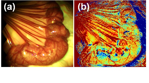 Multispectral bowel imaging