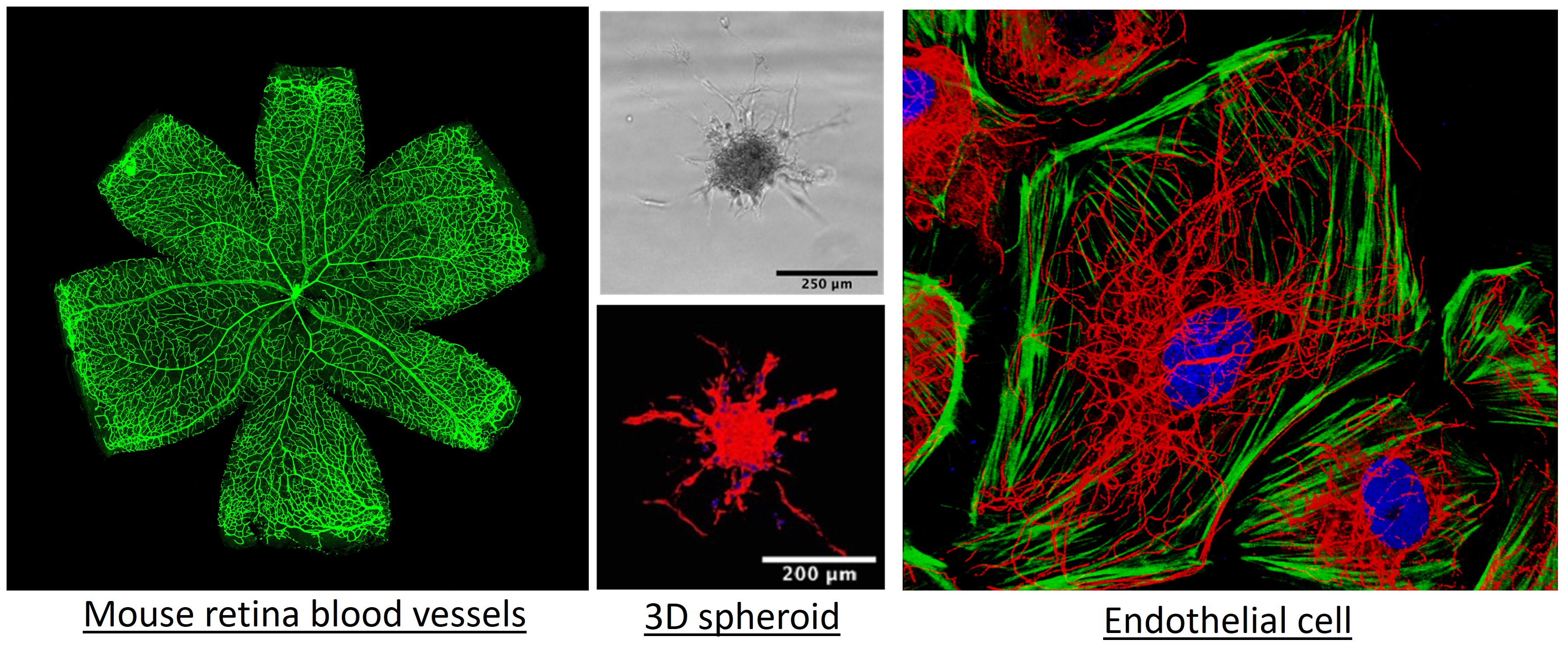 Microscopy images examples of Birdsey's group. Mouse retina blood vessels on the left, a 3D spheroid on the centre, and endothelial cells on the right 