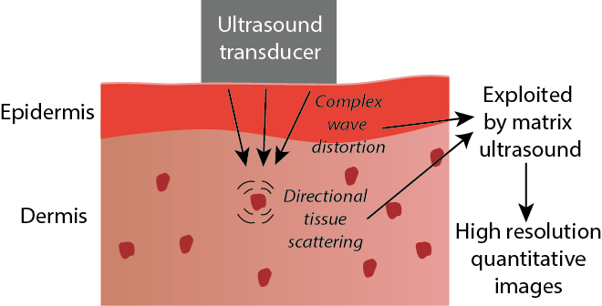  Process of ultrasound imaging of the skin for improved mapping of material properties