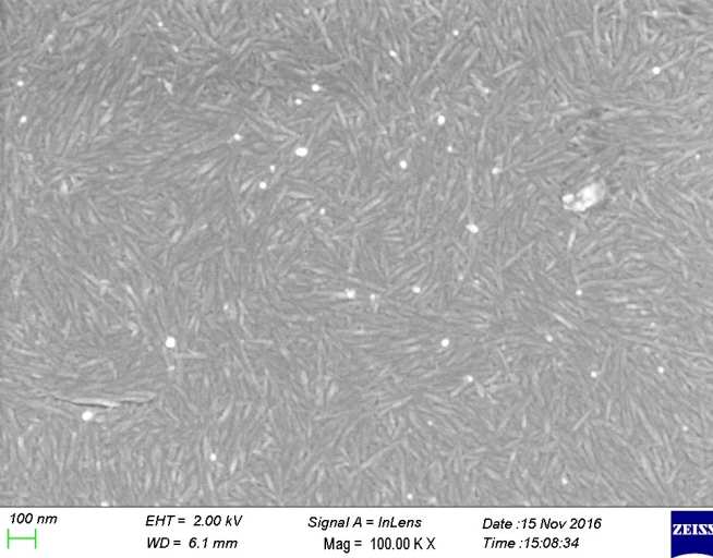 Scanning electron micrograph of nanocellulose 