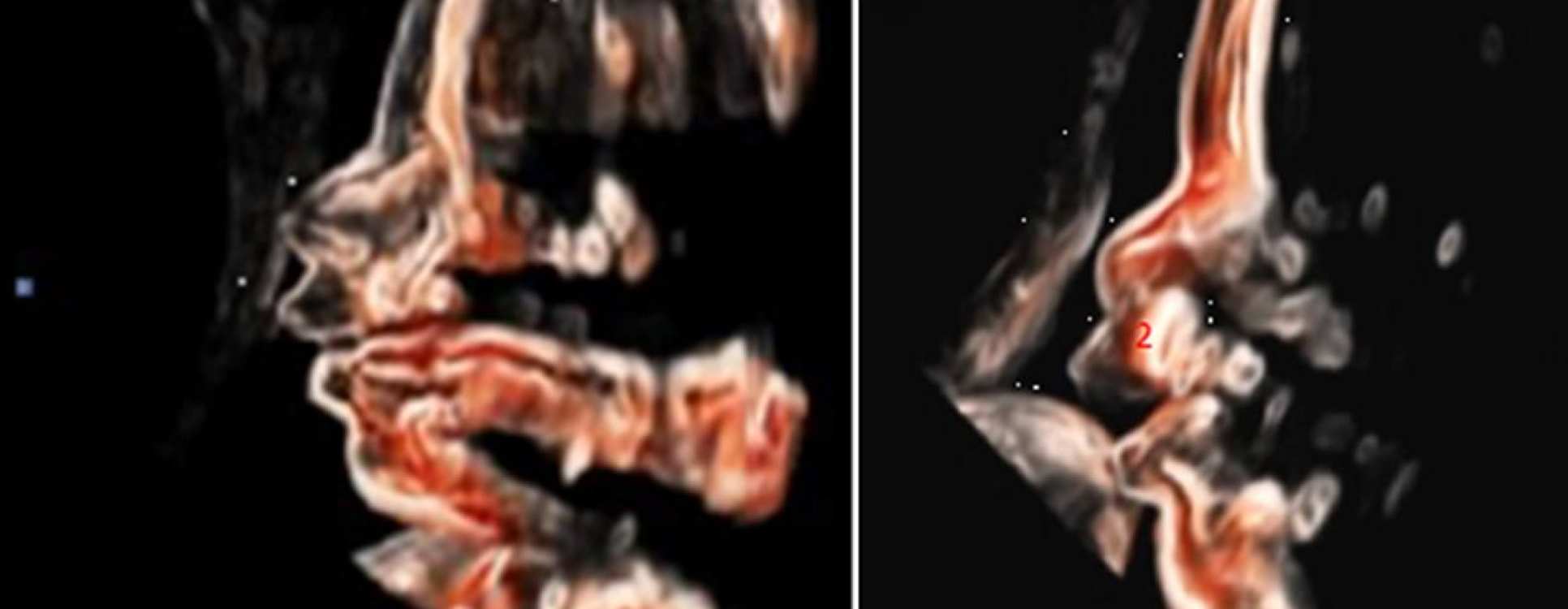 Imaging of a baby face