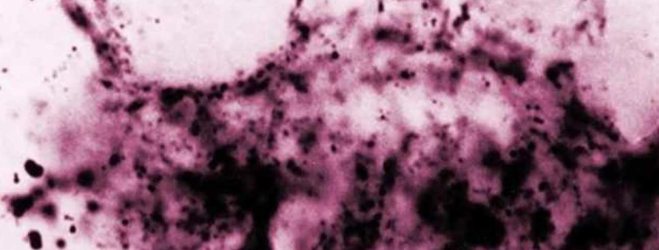 Purple and white pattern