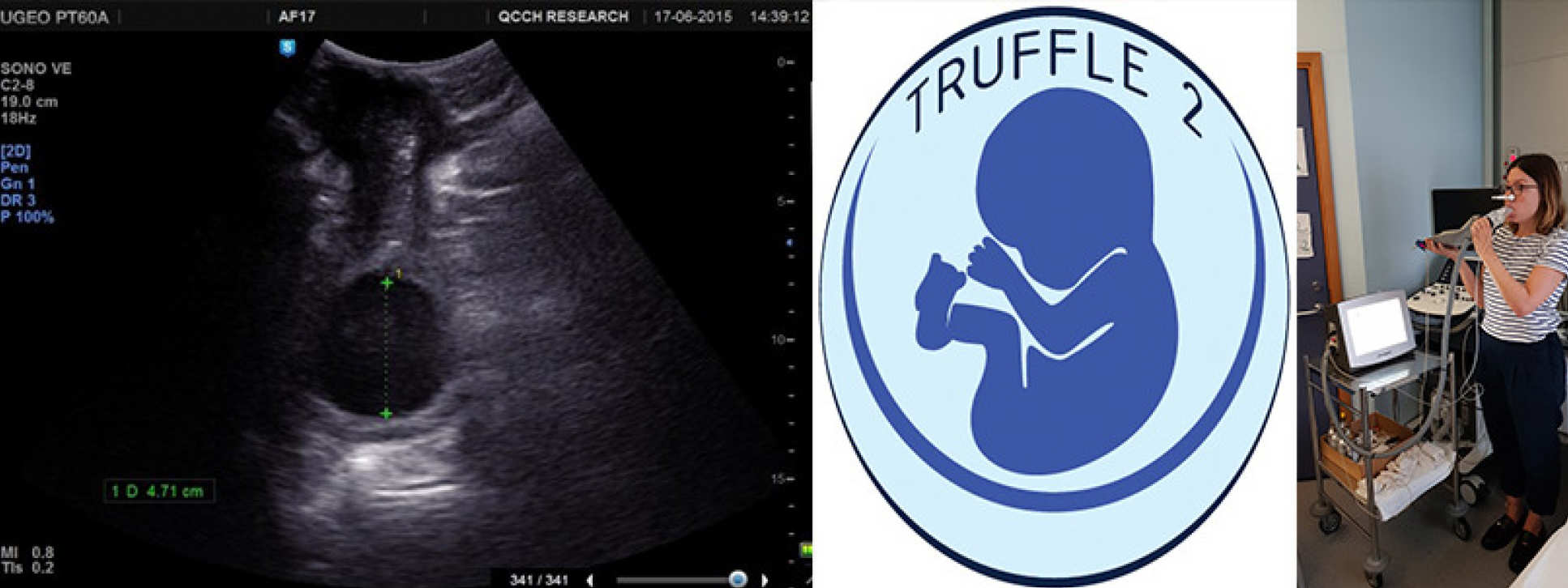 Fetal med combo image