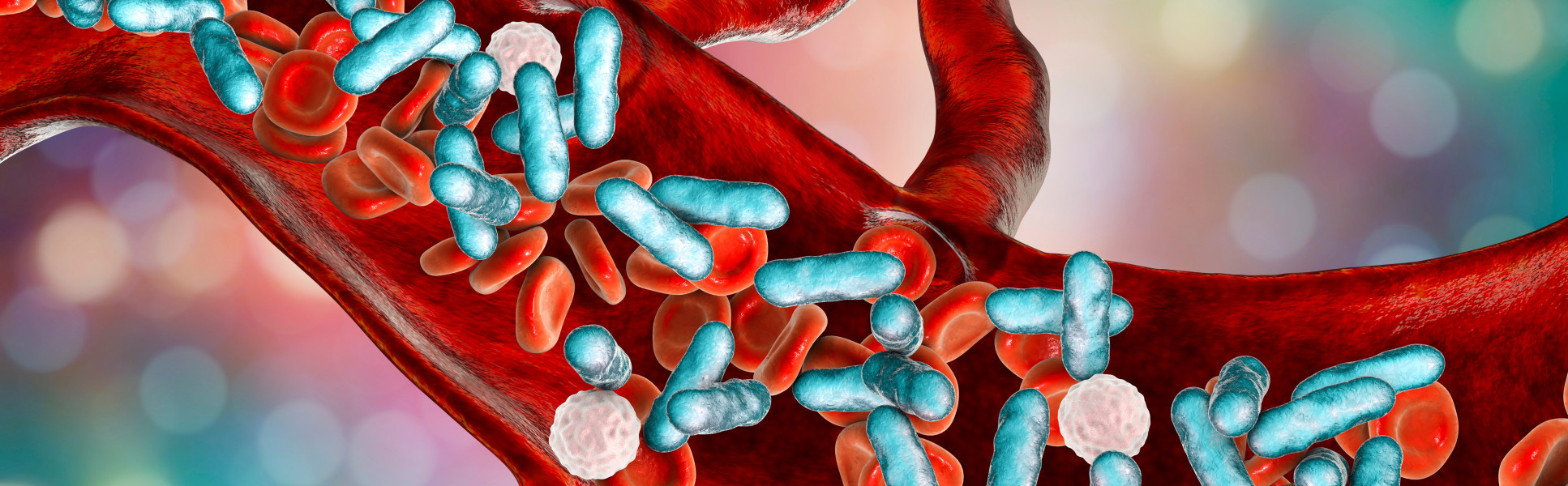 Graphical representation of sepsis