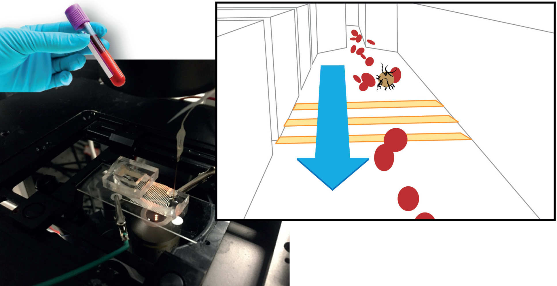 Detecting cancer cells in the blood