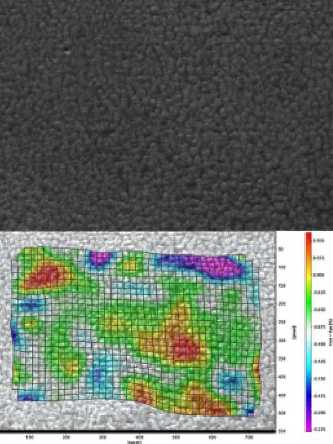   Radiograph of globular Al–15Cu containing 48vol.% solid in the process of shear and its divergence field