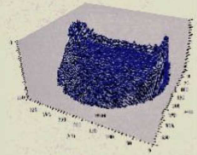 3-D map of film thickness of grease lubricated contact