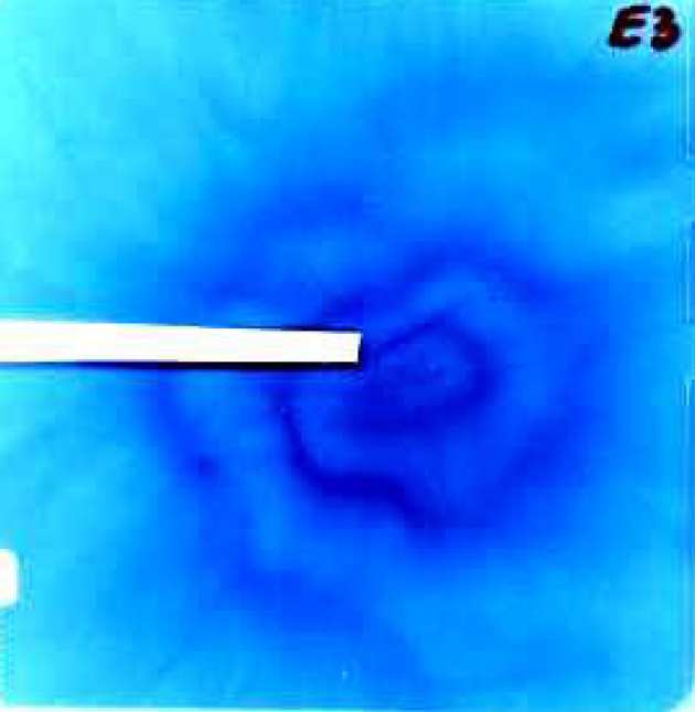 Figure: An unusual ring feature in a proton beam, recorded on radiochrome film (RCF)