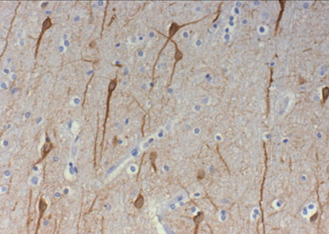 Anti-MAP2 in cingulate cortex IHC