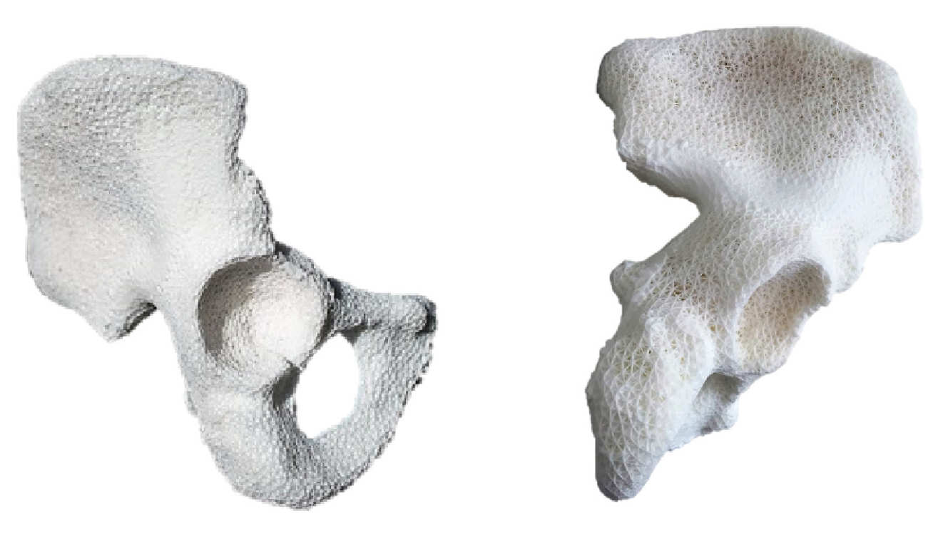 Pelvis3D