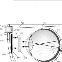 Retinal Prosthesis