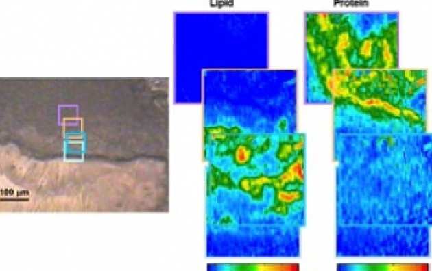 FTIR imaging of atherosclerotic plaque