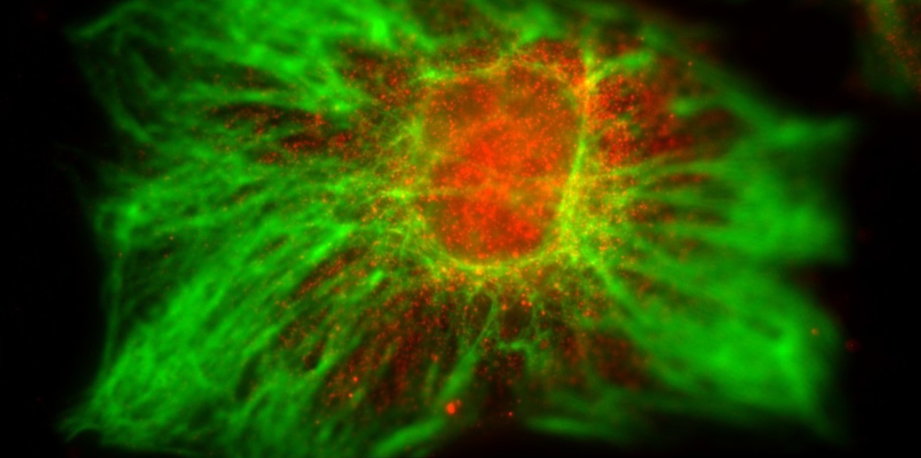 iPSC derived astrocytes