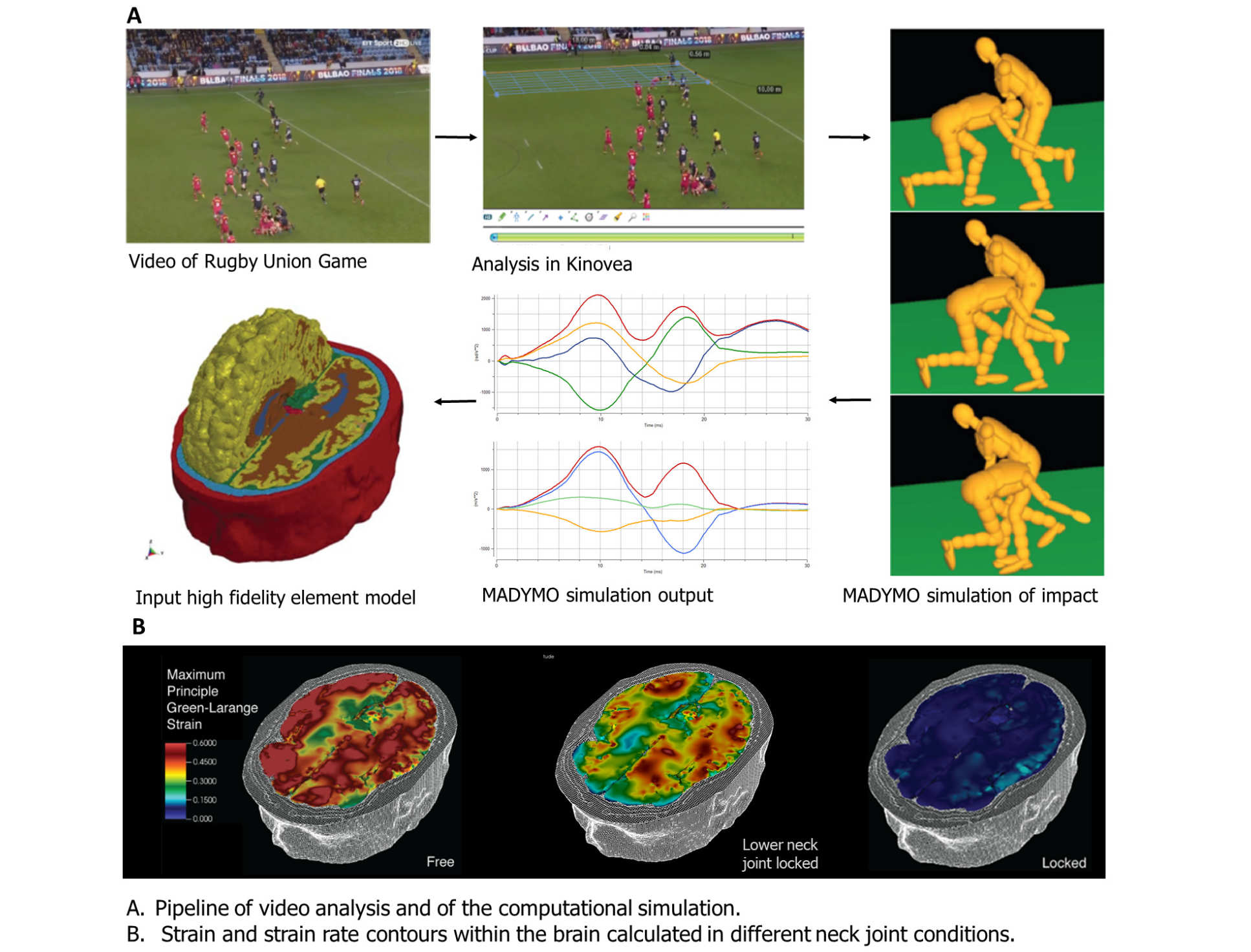 The pipeline of vieo analysis and of the computation simulation of rugby tackles, and the Strain and Strain rate contours within the brain calculated in different neck joint conditions.