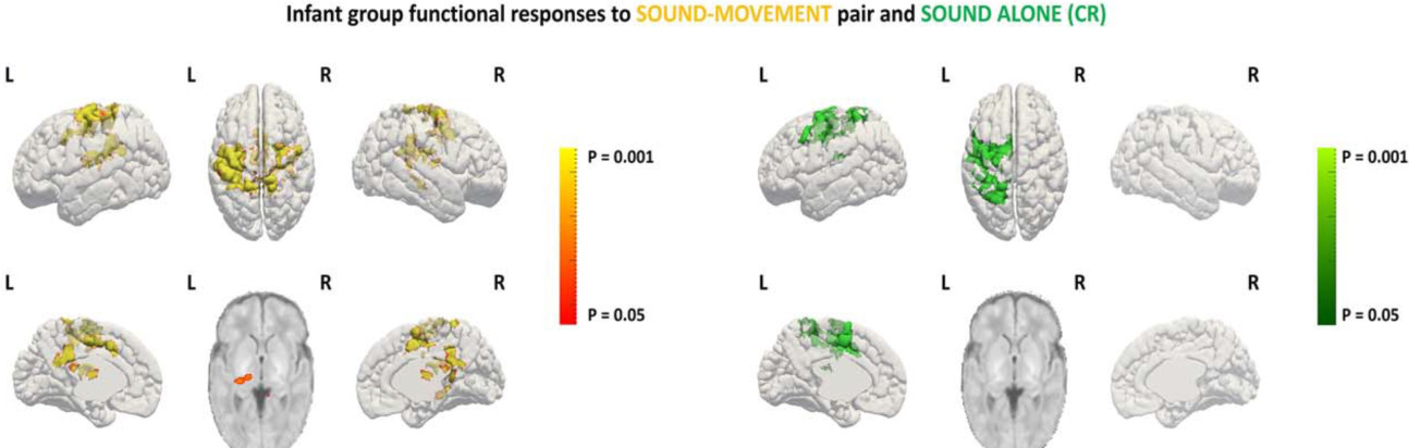 infantbrain