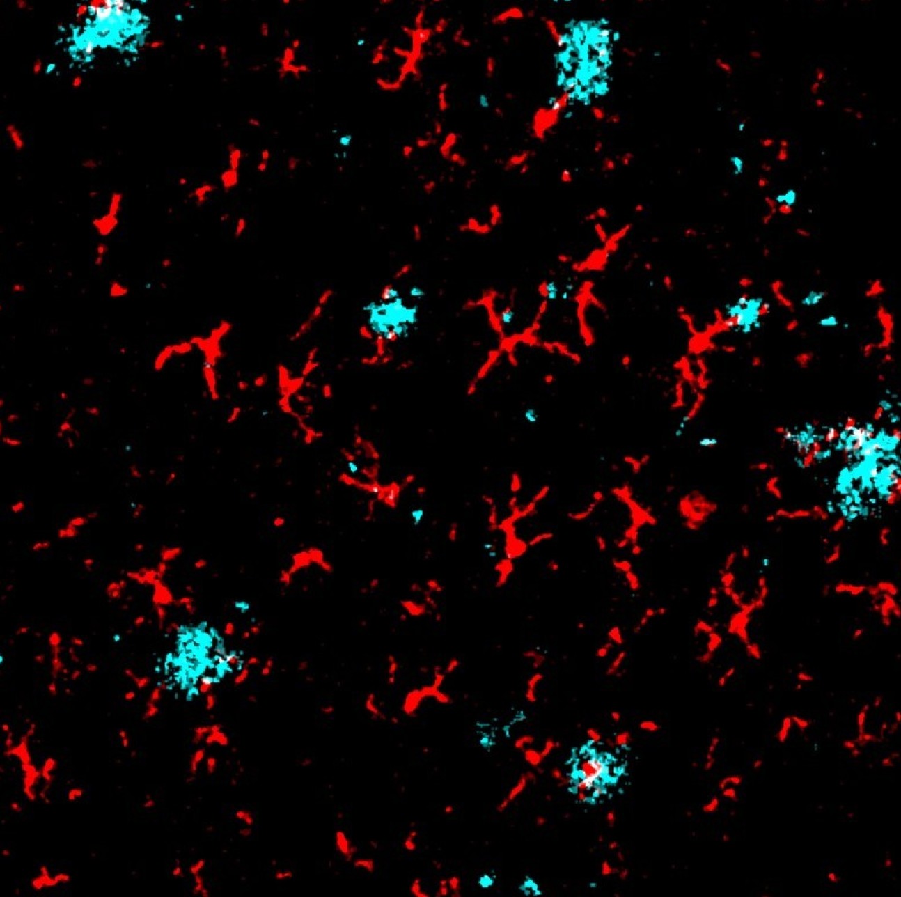 mass cytometry image of amyloid plaques and microglia
