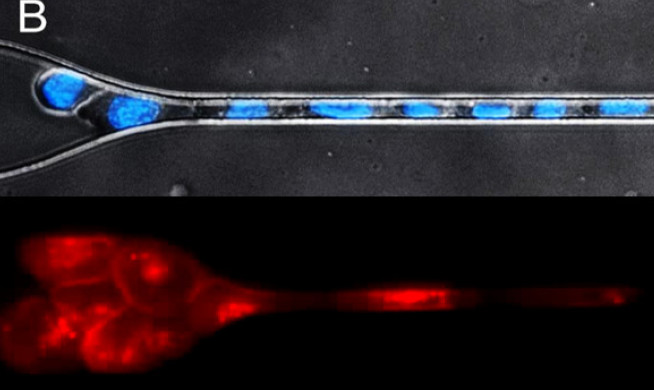 Circulating tumour cells passing through a constriction (Dr Sam Au)