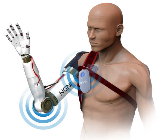 Next generation assistive technology will incorporate sensory feedback in addition to motor control to enable a more natural prosthesis