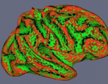 Red and green brain