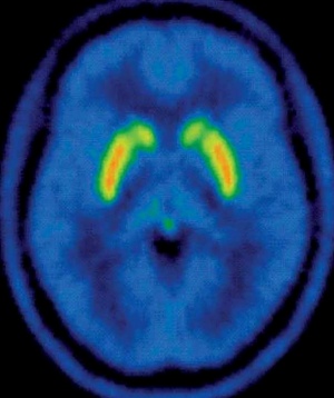 pet scan