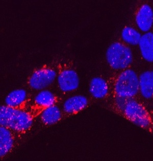Exosome 'parcels' (red) absorbed by placenta cells (blue