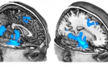   fMRI scans show reduced blood flow in the visual cortex (back of the brain) and limbic system (middle of the brain) under MDMA.