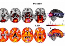 This image shows how, with eyes-closed, much more of the brain contributes to the visual experience under LSD than under placebo. The magnitude of this effect correlated with participants reports of complex, dreamlike visions.