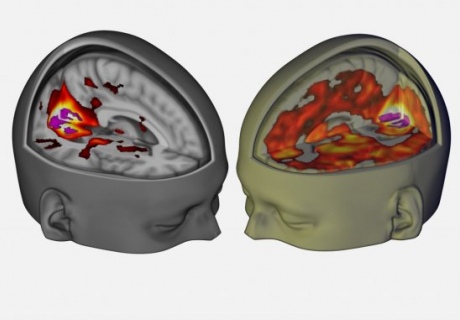 A computer visualisation of brain activity